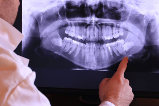 Best Emergency Tooth Extraction in Pine, AZ