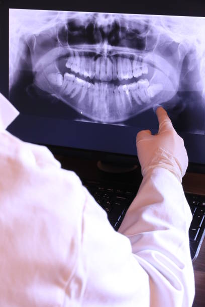 Best Emergency Treatment for Dental Infections or Abscesses in Pine, AZ